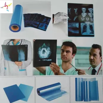 EPSON CANON HP için 175 mikron Mavi Mürekkep Püskürtmeli Tıbbi Film ve X-ışını CT CR DR MR ve PET-CT olarak kullanılan her türlü mürekkep püskürtmeli yazıcı